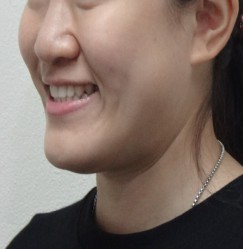 Case